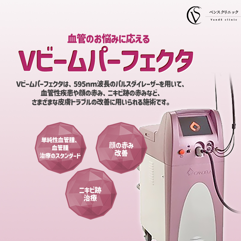 브이빔 - ホンデ店